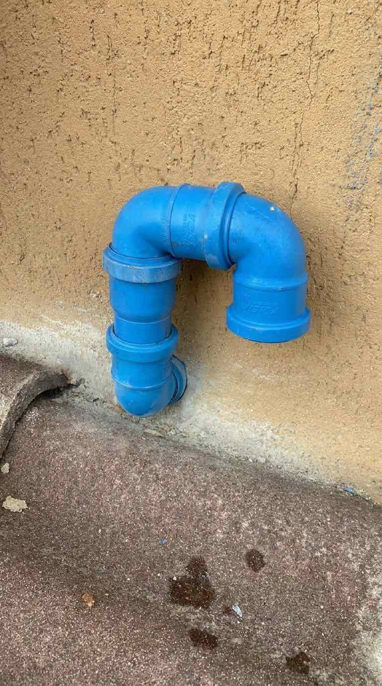 sfiato colonna fecale